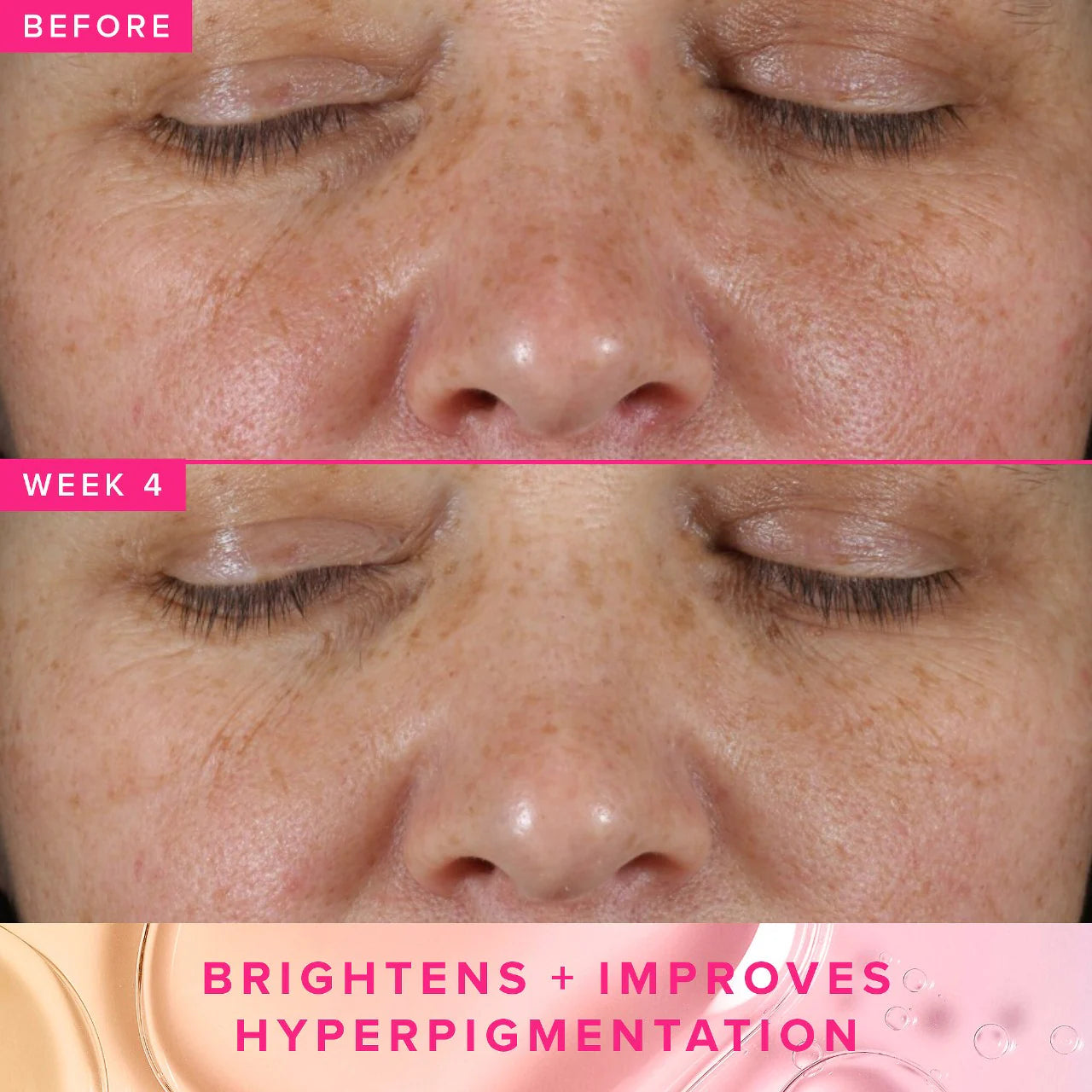 GO TONERRA BRIGHTEN+ TXA TONER