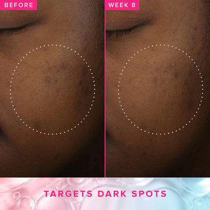 GO TONERRA BRIGHTEN+ TXA TONER